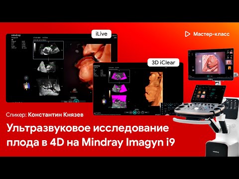 Видео: УЗИ плода в 4D на Mindray Imagyn i9. Мастер-класс для врачей