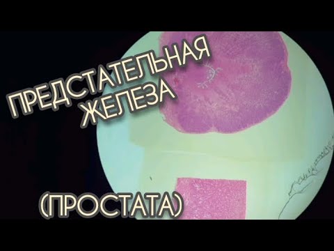 Видео: ПРЕДСТАТЕЛЬНАЯ ЖЕЛЕЗА или ПРОСТАТА