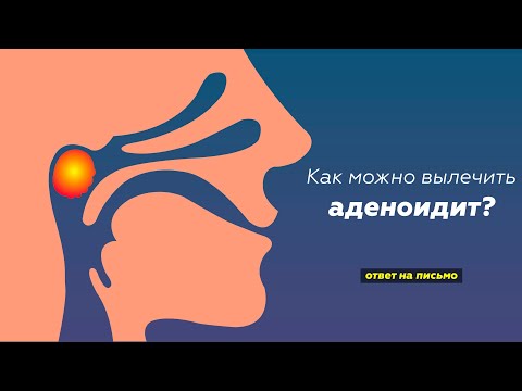 Видео: Как можно вылечить аденоидит? | Доктор Комаровский