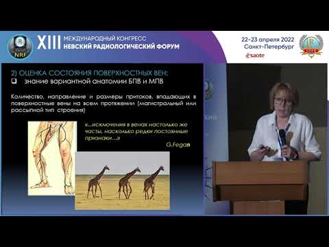 Видео: ВИЗУАЛИЗАЦИЯ ВЕН НИЖНИХ КОНЕЧНОСТЕЙ — ПРОБЛЕМЫ И РЕШЕНИЯ