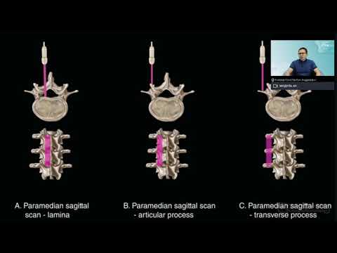 Видео: Ультразвуковая диагностика позвоночника