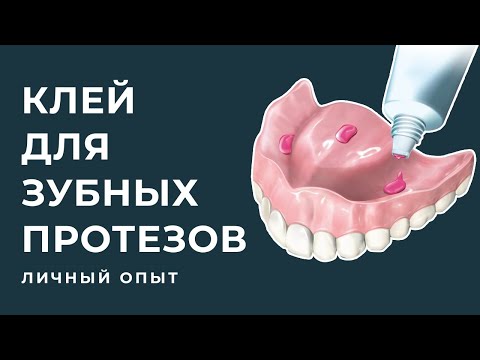 Видео: 37. Dentures/Съемные зубные протезы: Клей для зубных протезов.