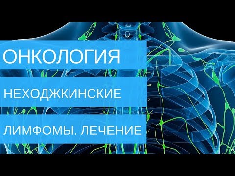 Видео: НЕХОДЖКИНСКИЕ ЛИМФОМЫ лечение 1, 2, 3, 4 стадий