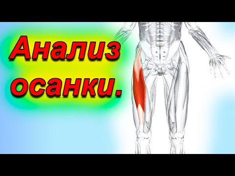 Видео: Как одна мышца меняет всю осанку.Прямая мышца бедра.Гиперлордоз поясницы