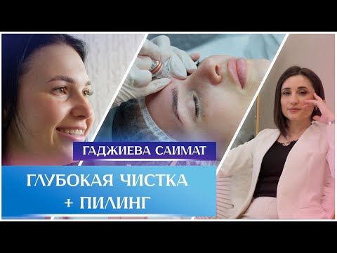Видео: @Глубокая чистка+лифтинг (водородный гидропилинг аппарат 7 в 1 H2O2)