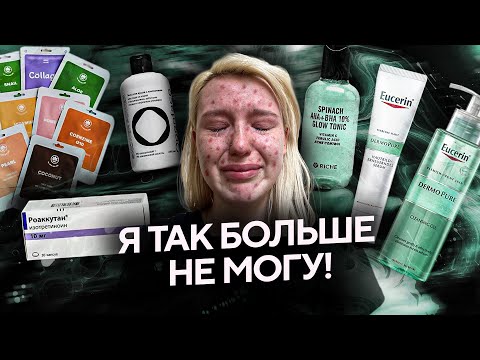Видео: Моя история ЛЕЧЕНИЯ АКНЕ | УХОД | РОАККУТАН