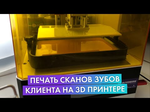 Видео: КАК ПЕЧАТАЕМ МОДЕЛИ ЗУБОВ КАЖДОГО КЛИЕНТА | ИНДИВИДУАЛЬНЫЕ СЪЕМНЫЕ ВИНИРЫ RUVENEERS