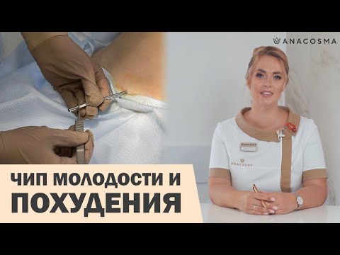 Видео: ГОРМОНАЛЬНЫЕ ПЕЛЛЕТЫ 🔥 БИОПЕЛЛЕТЫ 🔥 ЧИП МОЛОДОСТИ: КОГДА ОПАСНО ⛔️?