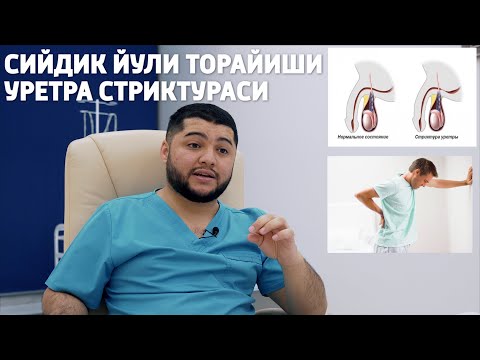 Видео: СИЙДИК ЙУЛИ КАСАЛЛИКЛАРИ СТРИКТУРА