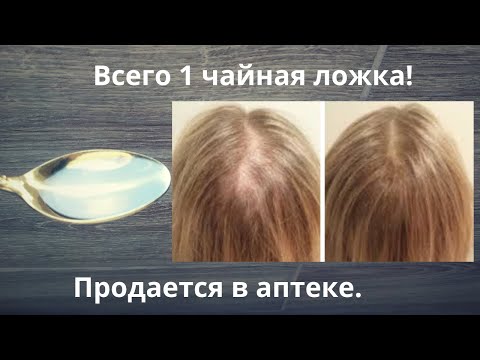 Видео: Копеечное средство продается в аптеке! Вместо дорогой косметики! Находка из аптеки!