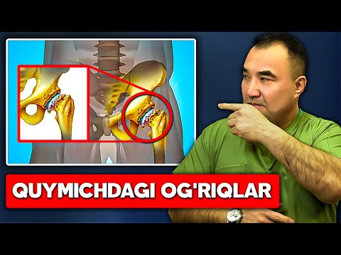 Видео: Koksartroz sabablari tasnifi va klinikasi 1-qism / Коксартроз сабаблари таснифи ва клиникаси 1-қисм