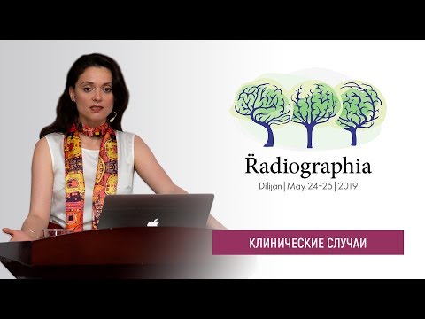 Видео: Ирина Трофименко. Когда звонит нейрохирург - подборка случаев