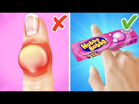 Видео: Зовите врача!💉🩸 Советы для экстремальных ситуаций | Лучшие лайфхаки для воспитания детей от 123 GO!