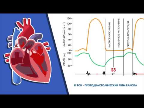 Видео: Аускультация сердца. Дополнительные тоны