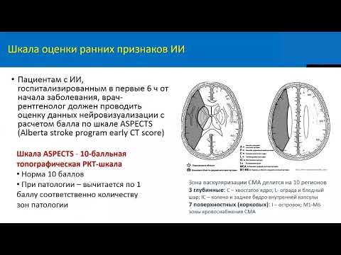 Видео: Диагностика ишемического инсульта