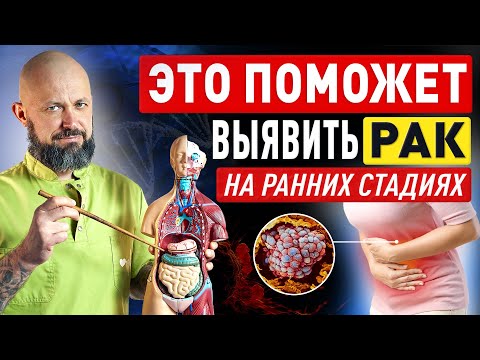 Видео: Эти симптомы ПОМОГУТ ВЫЯВИТЬ РАК на ранних стадиях || Способы диагностики онкологии