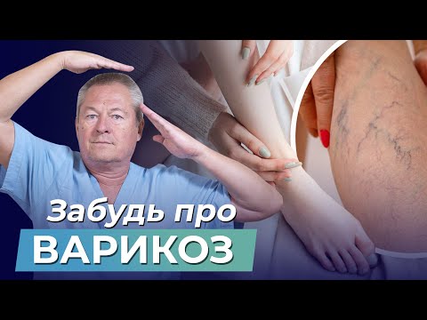 Видео: ВАРИКОЗ? Не БЕДА! Делайте ЭТО УПРАЖНЕНИЕ каждый день и ЗАБУДЬТЕ ПРО ВАРИКОЗ!