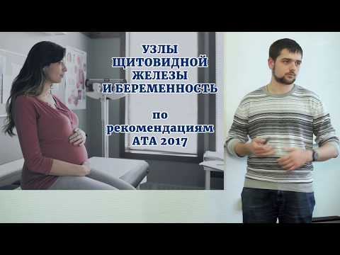 Видео: Узловой зоб и рак щитовидной железы при беременности