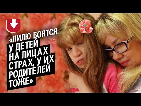 Видео: У моей дочери заячья губа, волчья пасть и пороки развития: Елена |Быть мамой