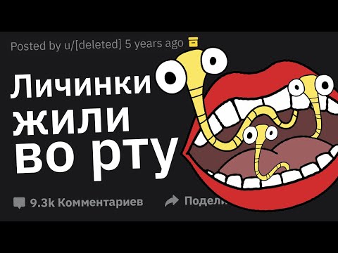 Видео: Врачи, с Какими Аномалиями в Теле Человека Вы Сталкивались?