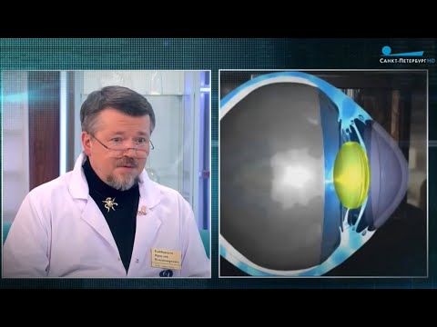 Видео: Отслоение сетчатки глаза | Байбородов Я.В. | Клиника им. С.Н. Федорова | Телеканал Санкт-Петербург