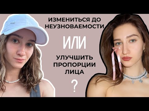 Видео: СДЕЛАЛА РИНОПЛАСТИКУ! Жила с комплексом 11 лет — моя честная история