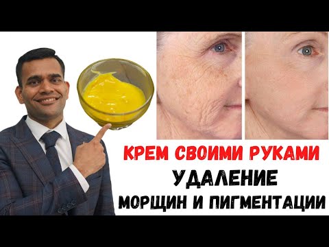 Видео: ЕДИНОЕ РЕШЕНИЕ ДЛЯ ВСЕХ ПРОБЛЕМ С КОЖЕЙ. Крем Для Удаления Пигментации И Морщин - Доктор Вивек Джоши