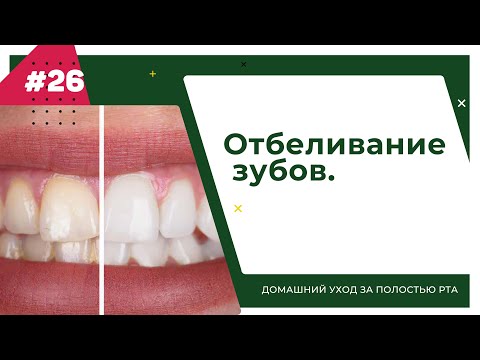 Видео: Отбеливание зубов. Урок №26 - ДОМАШНИЙ УХОД ЗА ПОЛОСТЬЮ РТА.