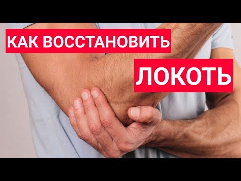 Видео: После травмы локтевого сустава контрактура, что делать?