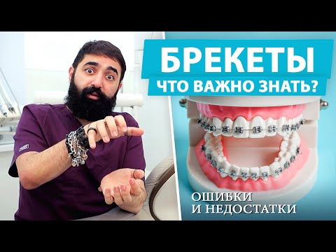 Видео: Брекеты: осложнения при ношении и как их предотвратить?