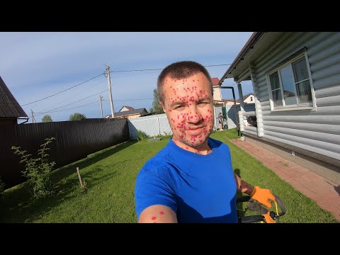 Видео: Ветрянка у взрослых, с первого дня и до выздоровления / 30 неделя 2023 года