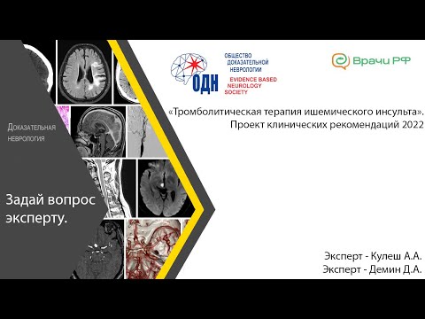 Видео: «Тромболитическая терапия ишемического инсульта». Проект клинических рекомендаций 2022