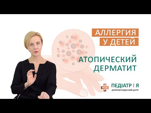 Видео: Аллергия у детей. Атопический дерматит. Школа детского питания Натальи Чернеги