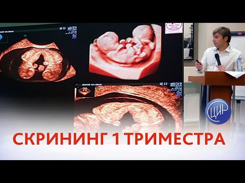 Видео: Скрининг 1 триместра 11-13 недель. Зачем делать скрининг в эру НИПТ? Курганников А.С.
