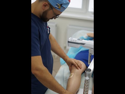 Видео: Синяки без причины