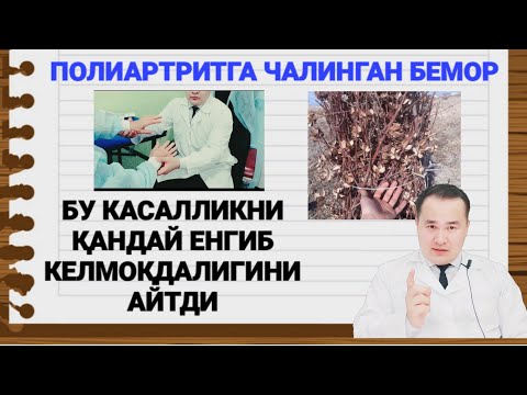 Видео: ПОЛИАРТРИТ ХАҚИДА / ДОКТОР ИСЧАНОВ ТАВСИЯСИ БИЛАН КАСАЛЛИКНИ ЕНГИБ КЕЛАЁТГАН БЕМОР БИЛАН СУҲБАТ