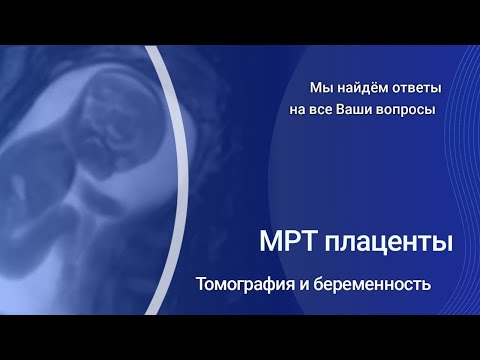 Видео: МРТ плаценты