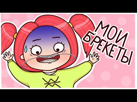 Видео: ИСТОРИЯ моих БРЕКЕТОВ 🦷😬Анимация Вэлл
