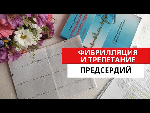 Видео: ЭКГ диагностика нарушений ритма сердца. Фибрилляция и трепетание предсердий.