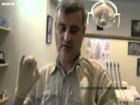 Видео: Ультразвуковой скалер в стоматологии.Часть №3