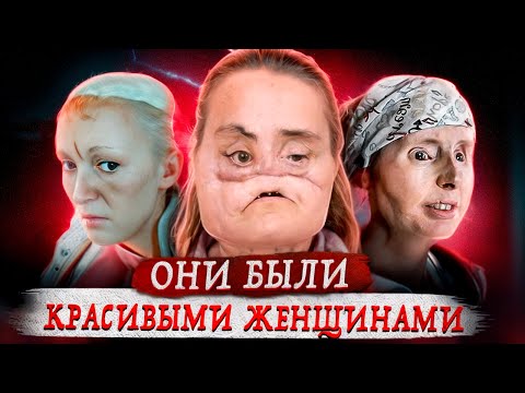 Видео: Выжили, чтобы рассказать правду !
