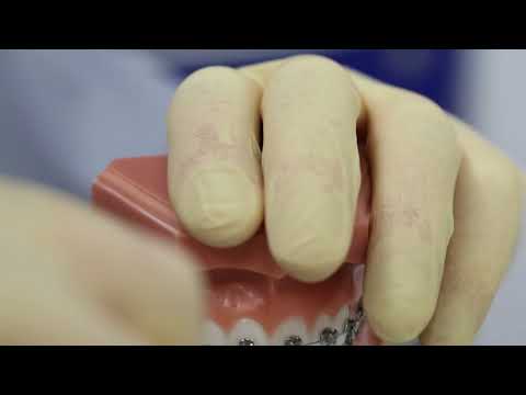 Видео: №6.Что делать если отклеился брекет