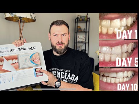 Видео: ПРОФЕСИОНАЛНО ИЗБЕЛВАНЕ НА ЗЪБИ У ДОМА! 🦷
