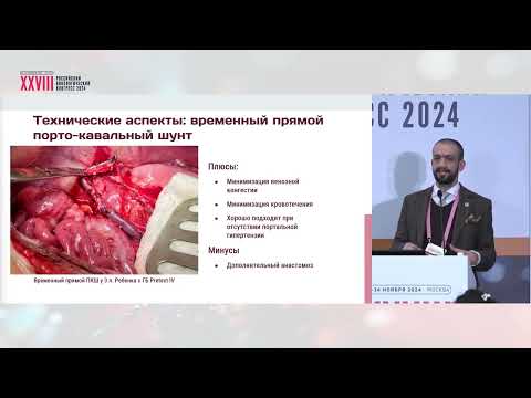 Видео: Роль пересадки печени в лечении гепатобластомы