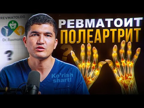 Видео: Ревматоид артрит: сабаблари, белгилари ва даволаш усуллари +998944856362