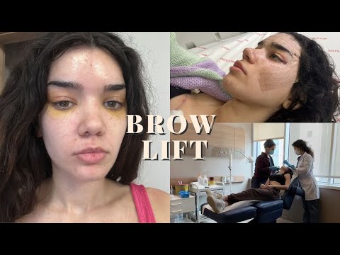 Видео: Повдигане на вежди - седмица 1