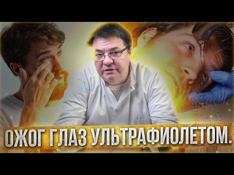 Видео: Ожог глаз ультрафиолетом.