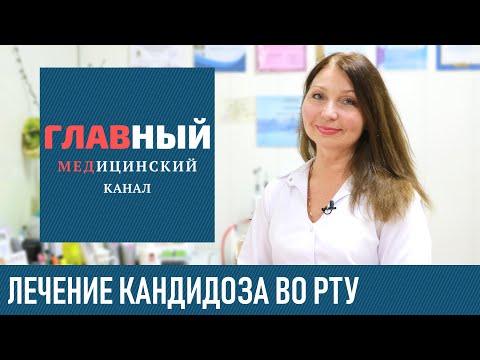 Видео: Быстрое Лечение Кандидоза во Рту у ребенка и взрослых. Лечение молочницы ротовой полости