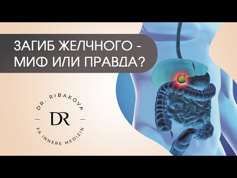 Видео: Загиб желчного пузыря - миф или правда?