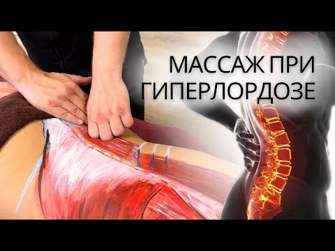 Видео: Нижний перекрестный синдром | Передний наклон таза и боль в пояснице